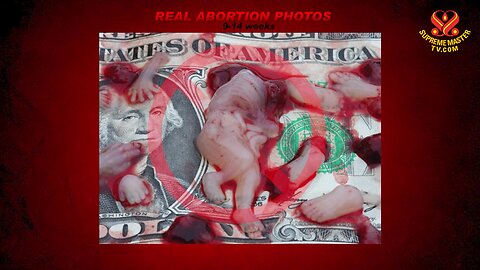 Abortion is murder, is a great CRIME AGAINST HUMANITY