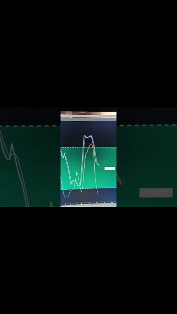 Bitcoin Is About To Close The Trap. Again. #Shorts