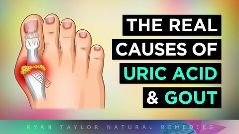 The Real Causes of GOUT and Uric Acid Build-up