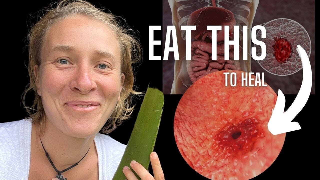 4 Foods That Quickly Heal Stomach Ulcers—Start Eating Now!