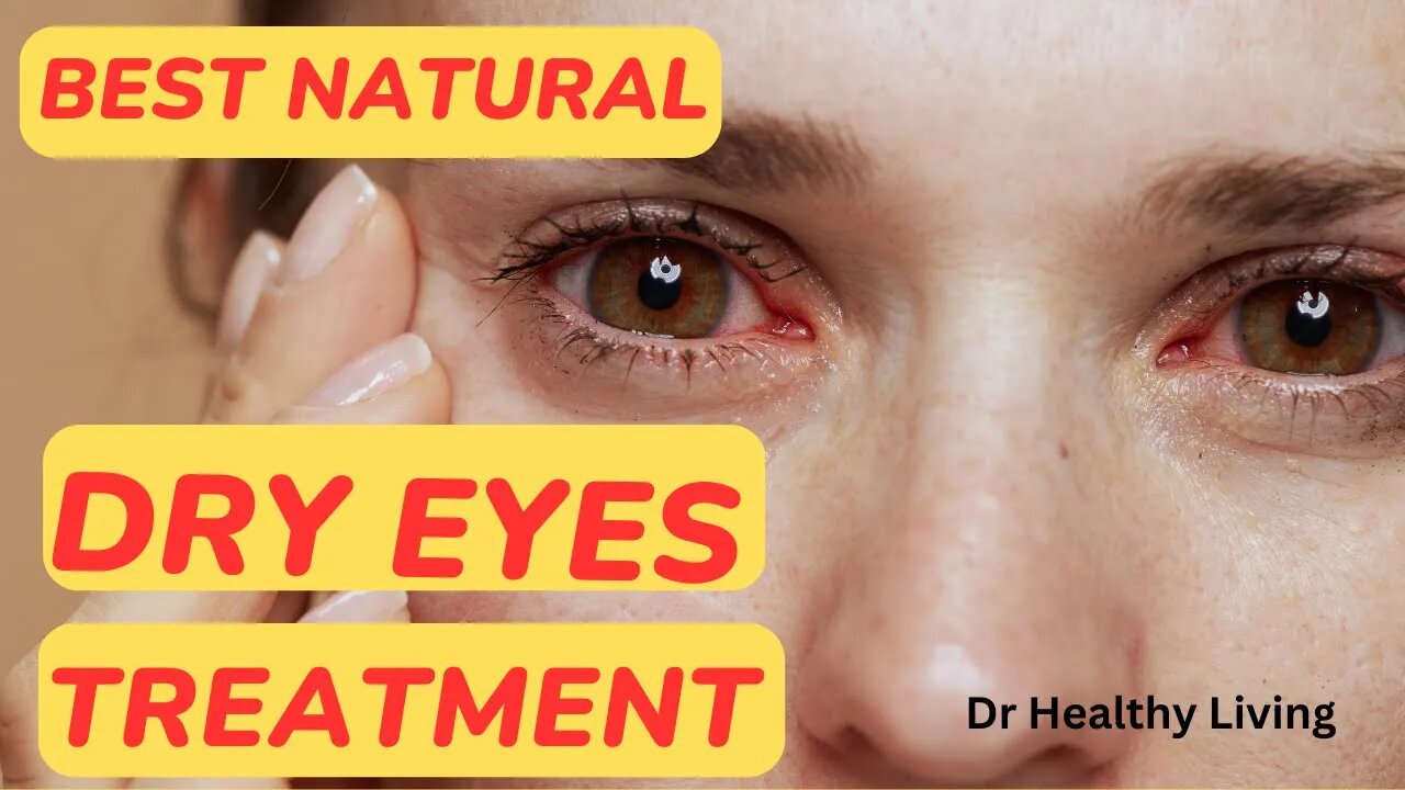 Best Natural Dry Eyes Treatment/Dr. Healthy Living