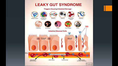 Gluten, Glyphosate and the Gut