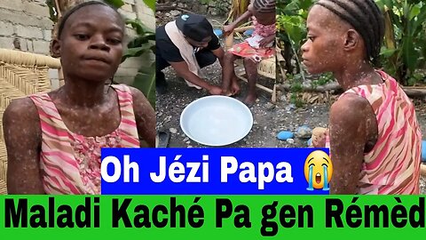 Oh Jézi Papa 😭 😭 Maladi Kaché Pa Gen Trétman..Li Grav anpil...Kèw Ka Raché Wi Lew Ap Gadé L.....