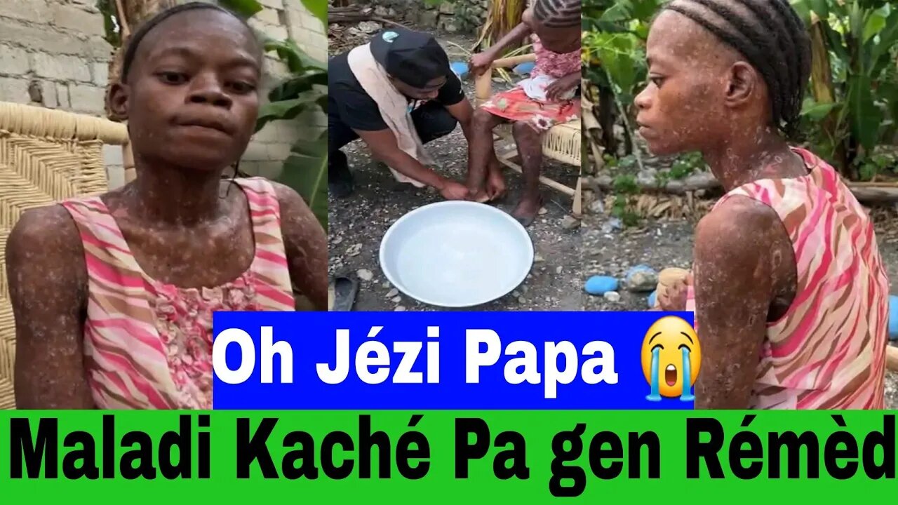 Oh Jézi Papa 😭 😭 Maladi Kaché Pa Gen Trétman..Li Grav anpil...Kèw Ka Raché Wi Lew Ap Gadé L.....