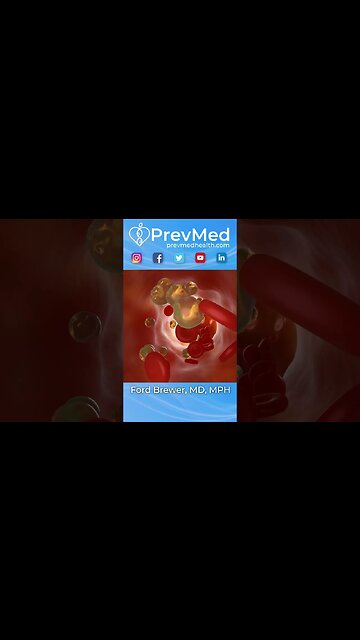 #SHORTS The Real Issue With High LDL