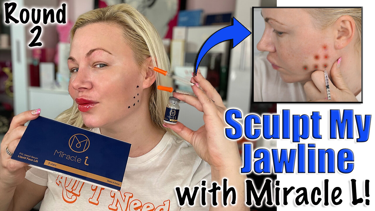 Sculpt my Jawline with Miracle L from AceCosm.com, Round 2 | Code Jessica10 Saves you Money!