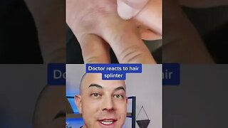 Derm reacts to crazy hair splinter! #barber #hairsplinter #dermreacts #splinterremoval