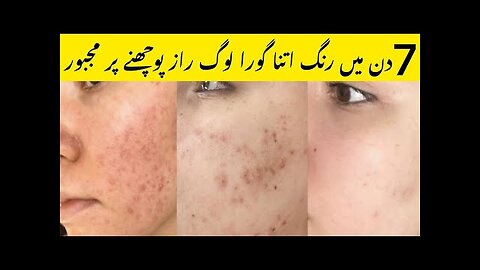 Pigmentation removal remedy ✨💯❤️ glowing skin care/Bright skin