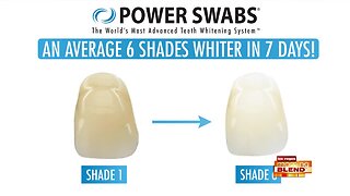 Smile Brightly With Whiter Teeth