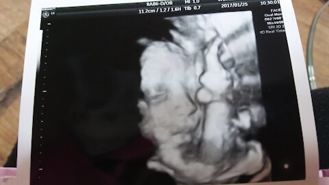 a two month old baby