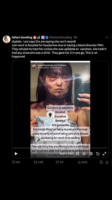 ⚠️ Warning. Not for the faint of heart. 🤮🤮🤮