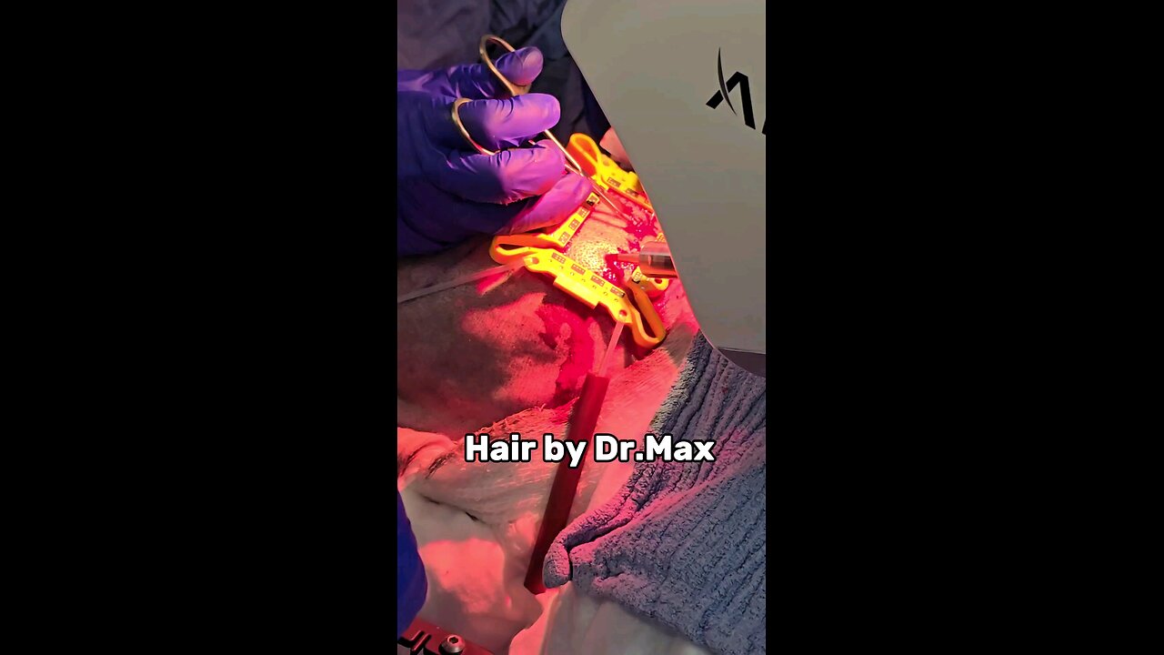 Experience the difference in hair restoration at Hair by Dr.Max Restoration Center