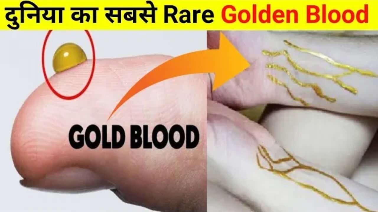 Gold से भी महंगा 🤑 Golden Blood 😱 #shorts #facts #motivation #fact