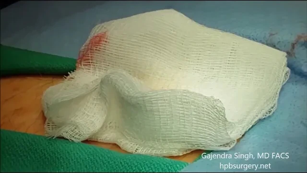 የደረት ቀዶ ጥገና - chest surgery