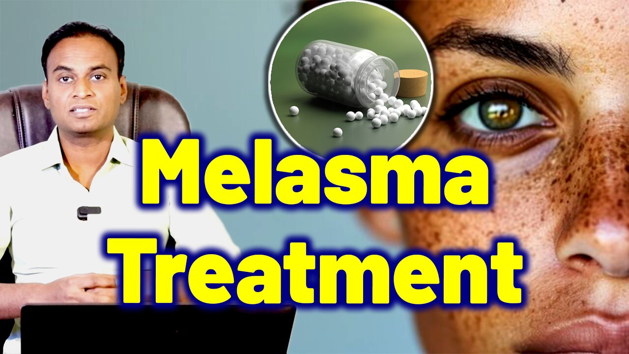 Conventional Treatment Disadvantages & Homeopathy Treatment Advantages in Melasma Treatment & Cure