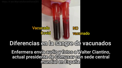 Diferencia en la sangre de vacunados.