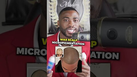 How to get your hairline back