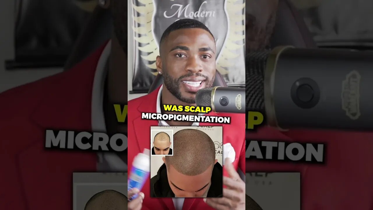 How to get your hairline back