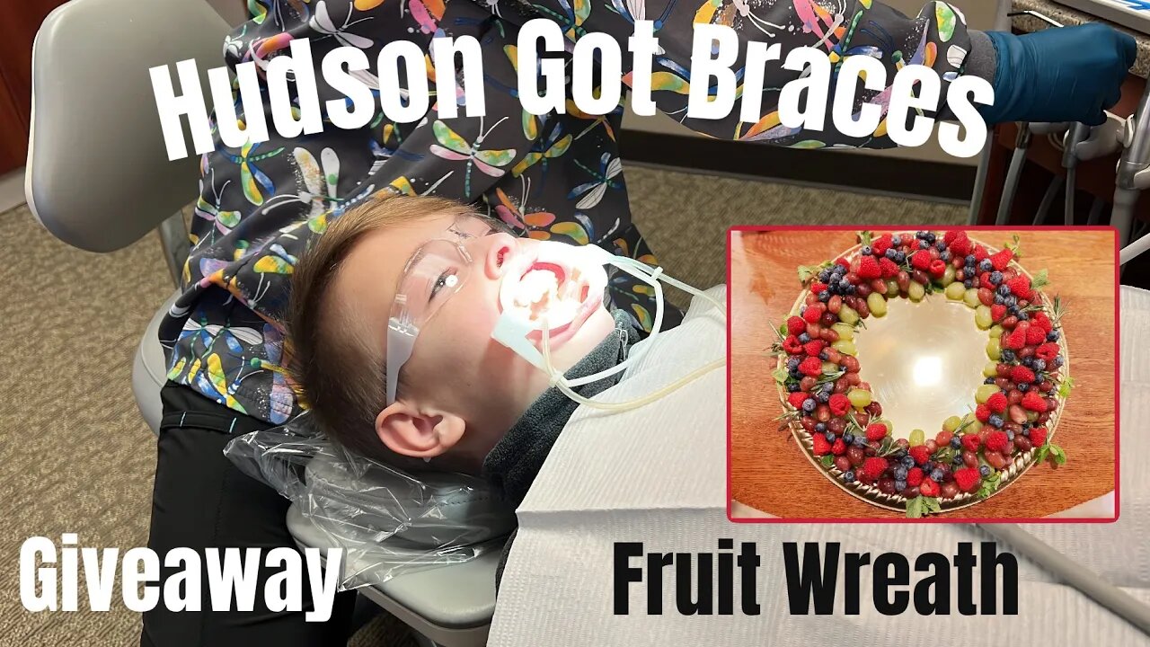 *Giveaway* | Hudson Got Braces | Fruit Wreath Charcuterie | Madam Glam Nails