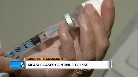 Rise in out-of-state measles cases poses threat to Wisconsin