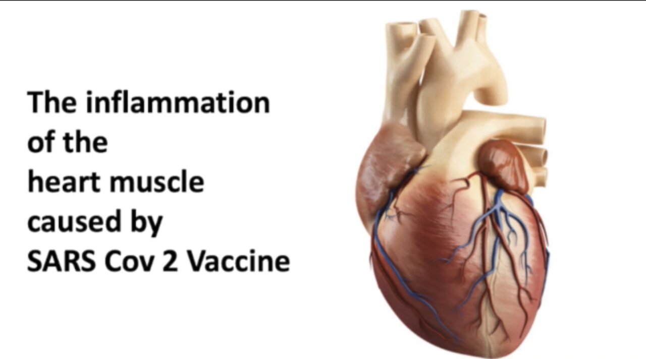 Dr. Joseph Thoma - The inflammation of the heart muscle caused by SARS Cov 2 vaccine 2-22-2022