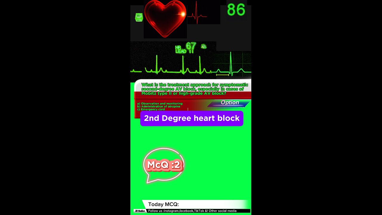 Second degree heart blockages #2nddegreeheartblock #arrthymias #CardiacArrhythmia