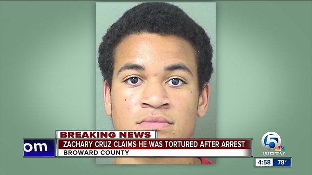 Zachary Cruz claims he was tortured after his arrest in Broward County