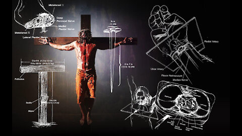 Jesus’ Suffering and Crucifixion - A Medical Point of View