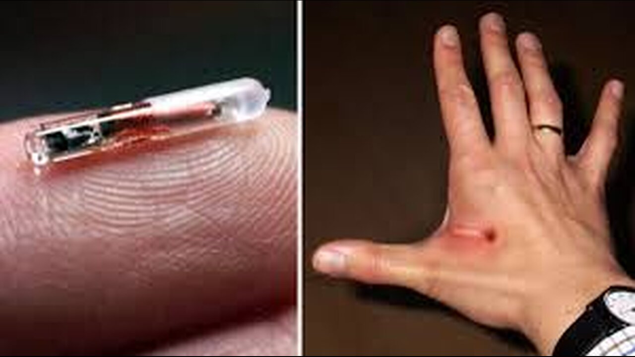 BIOCHIP IMPLANT