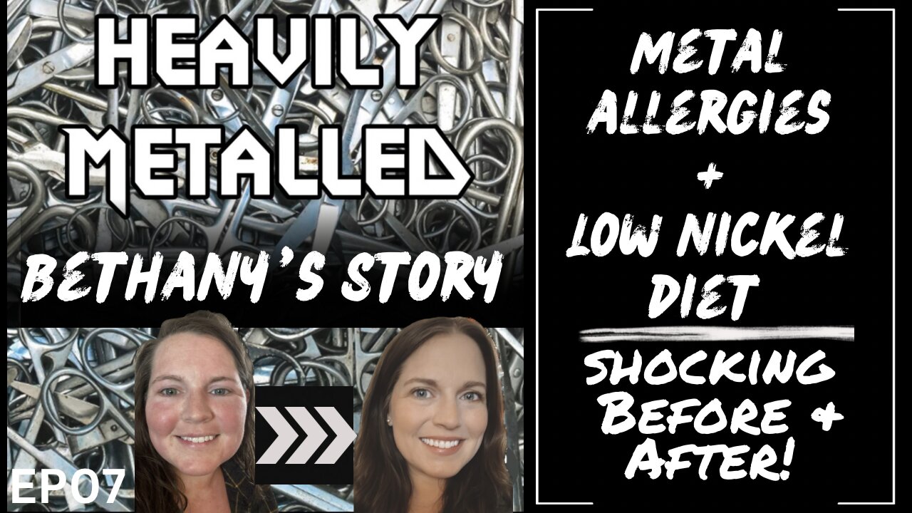 EP07 - Metal Allergies & the Low-Nickel Diet: SHOCKING Before & After