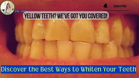 Can Yellow Teeth Become White Again? | Doctor MAI