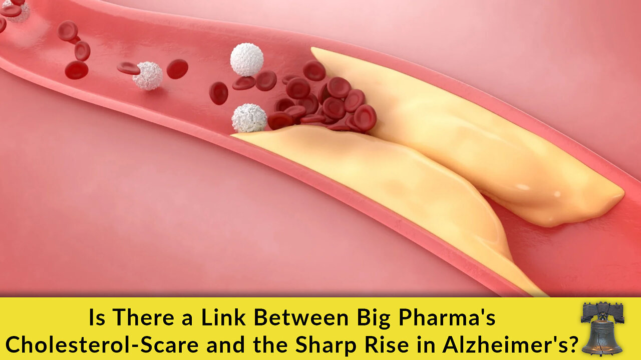 Is There a Link Between Big Pharma's Cholesterol-Scare and the Sharp Rise in Alzheimer's?