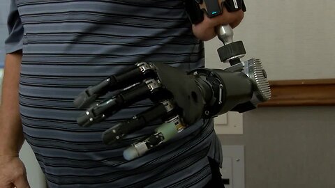 Pioneer of world's most advanced prosthetic arm has Tucson ties