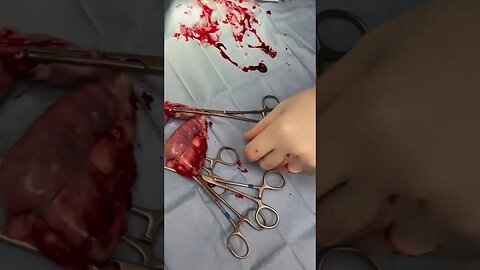 Pyometra surgery in a dog. #veterinary #surgery #pyometra #spay_and_neuter #abscess #infection