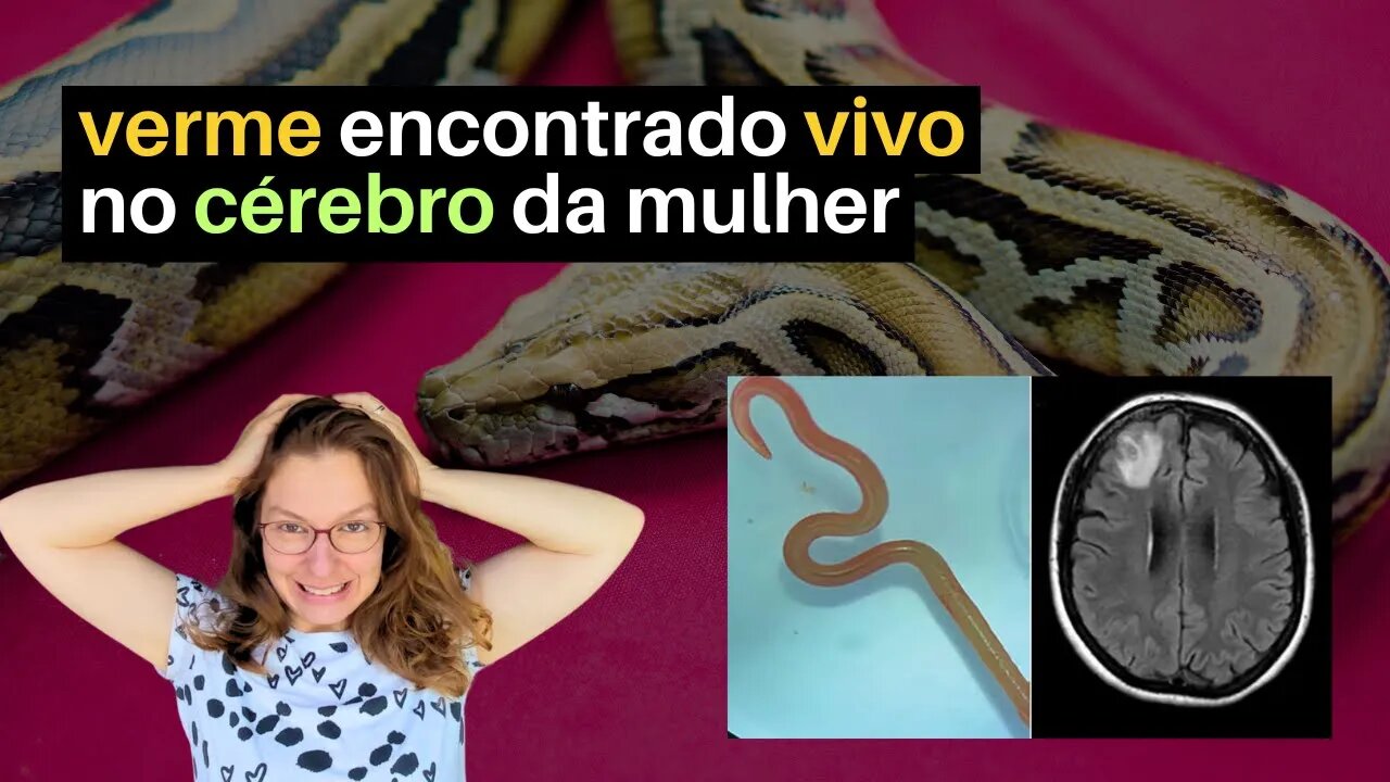 Verme encontrado vivo no cérebro de mulher australiana