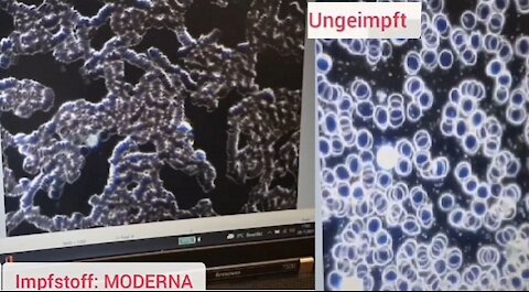 Blutuntersuchung von Geimpften & Ungeimpften Menschen unter dem Mikroskop