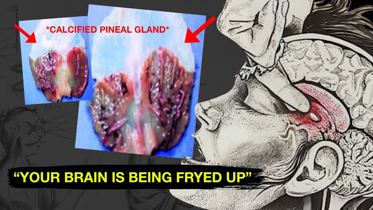 Why the US Wants to Destroy Your Pineal Gland