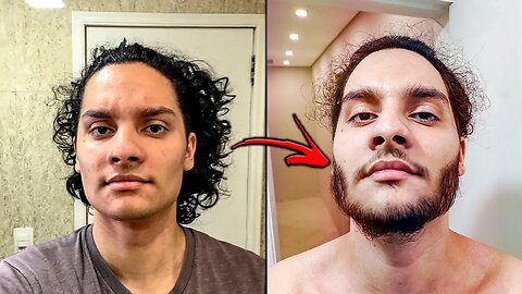 EVOLUÇÃO MINOXIDIL ANTES X DEPOIS | EVOLUÇÃO 1 FOTO POR DIA | DEIXANDO A BARBA CRESCER