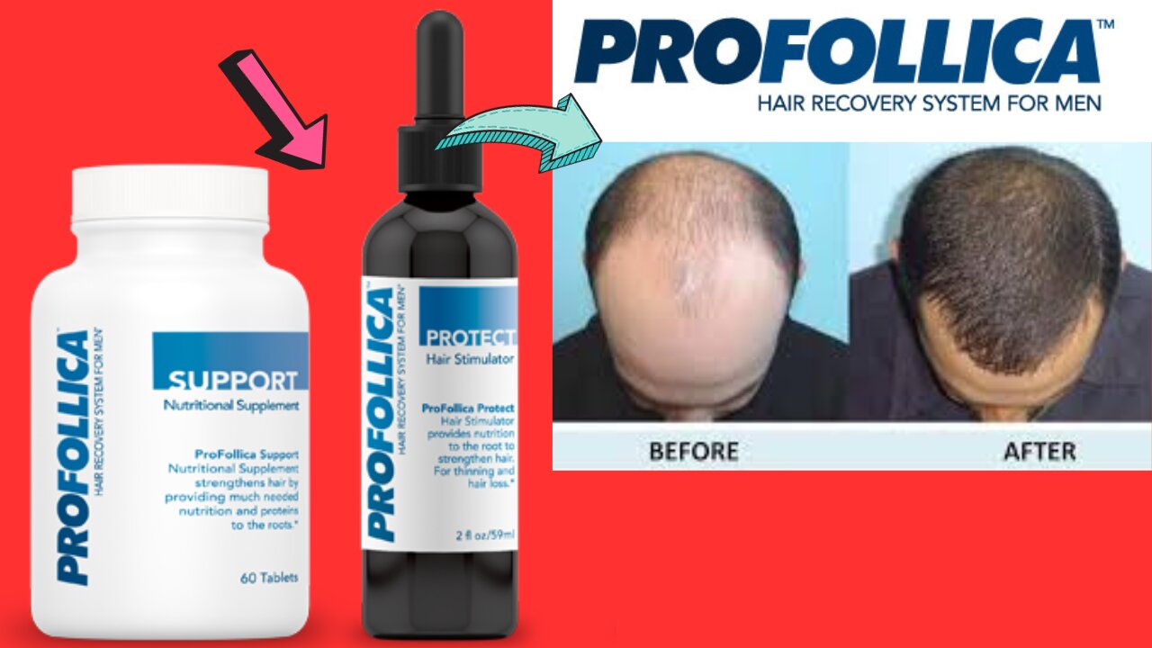 Transform Your Hair Game: Profollica Reviews, Discounts, and Where to Buy