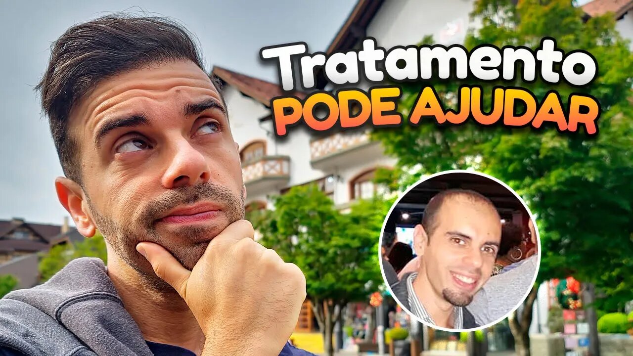 Calvície tem cura? NÃO, mas esse tratamento vai ajudar!