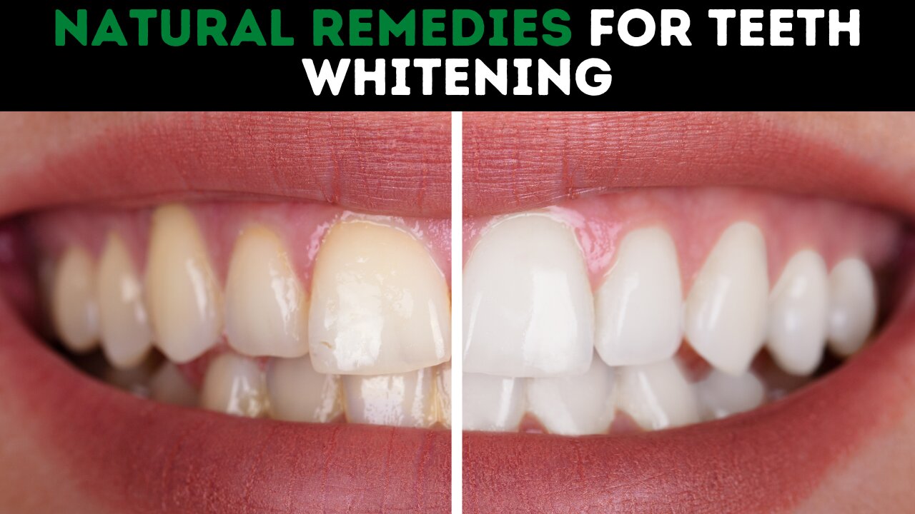 Natural Remedies For Teeth Whitening