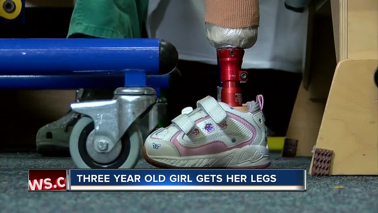 3-year-old little girl learns to walk for first time after amputation with help of local hospital