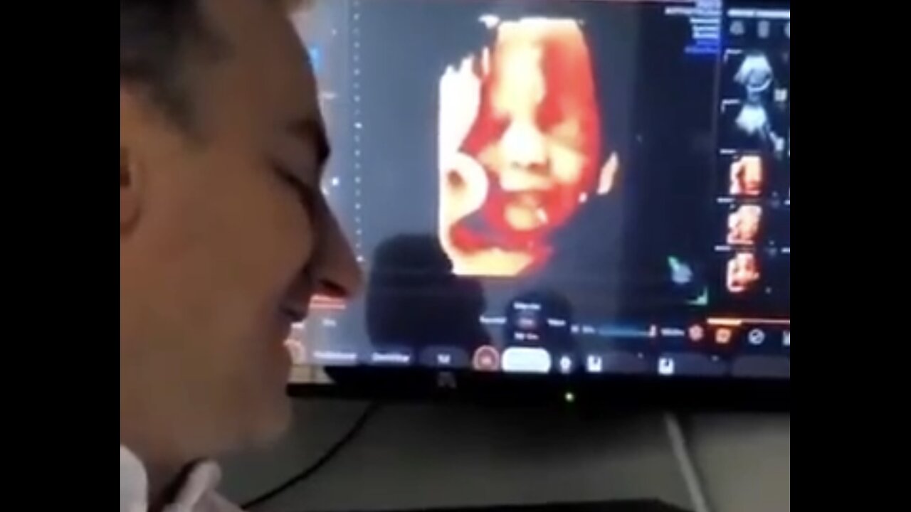 Unborn Baby 🥰 Smiles At Sound Of Fathers Voice ❤️