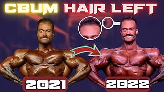 Chris Bumstead: Losing More Than Hair?