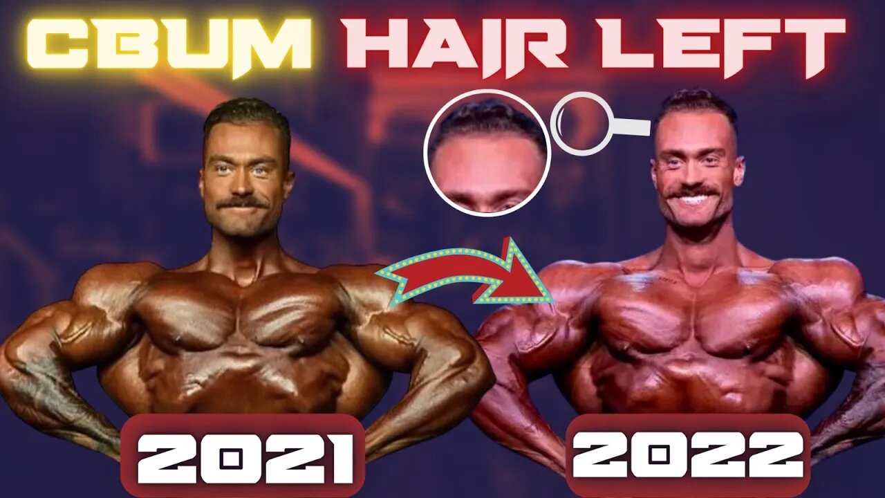 Chris Bumstead: Losing More Than Hair?