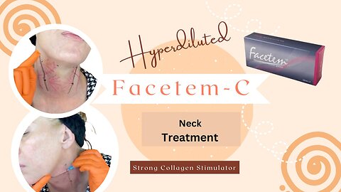 Facetem-C CaHA Hyperdilution