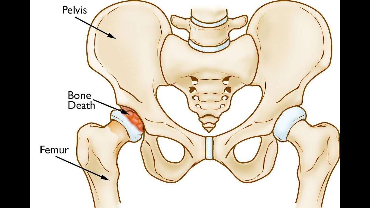 Hips Don't Lie: HHO "Browns Gas" report after 6 days of tablets