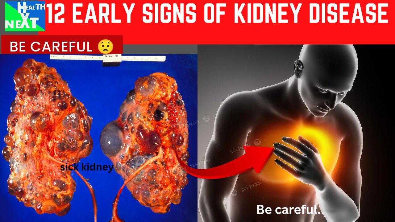 12 EARLY SIGNS OF KIDNEY DISEASE .