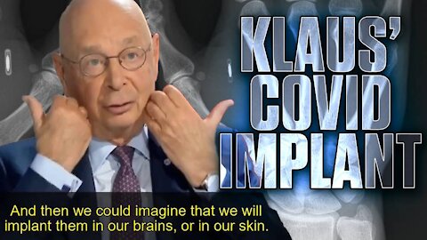 BREAKING- "Implant Everyone On Earth With A Tracking Microchip" Says Klaus Schwab