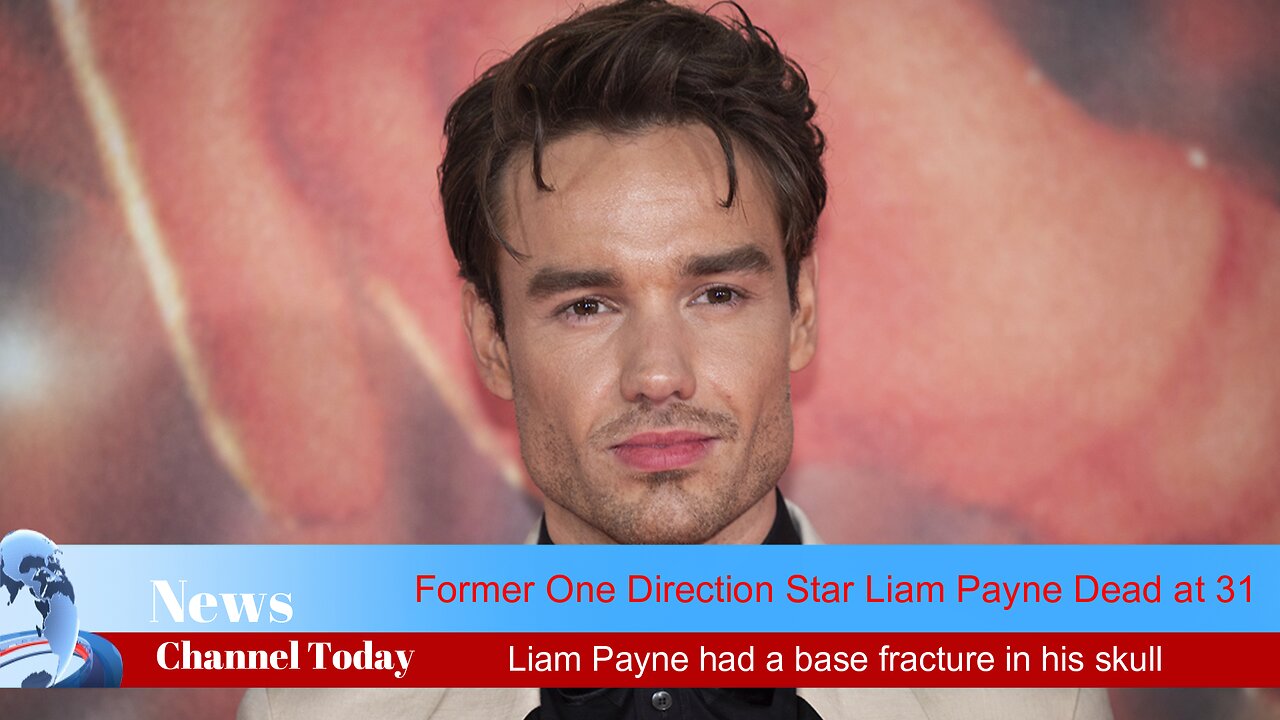 Liam Payne had a base fracture in his skull